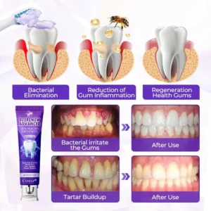 Cvreoz® BeeRenew Advanced Gum Healing Toothpaste