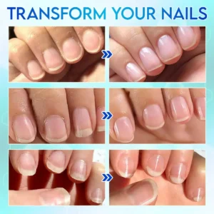 AuraTrim Care™ 360 Automatic Nail Trimmer