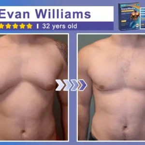 GFOUK® NanoMedix Gynecomastia Chest Fatburn & Firm Patch