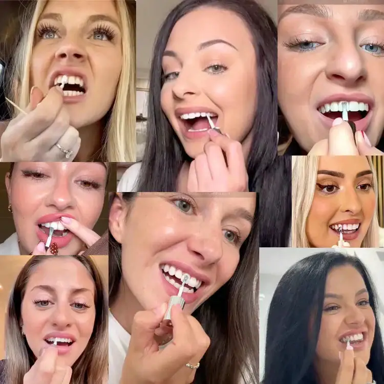 LOVILDS™ Teeth whitening - Instant Whitening for a Sparkling Smile