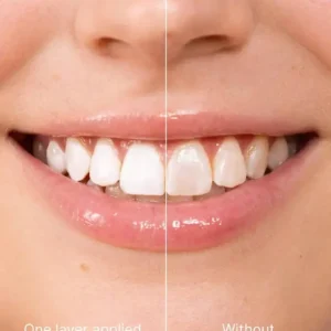 LOVILDS™ Teeth whitening - Instant Whitening for a Sparkling Smile