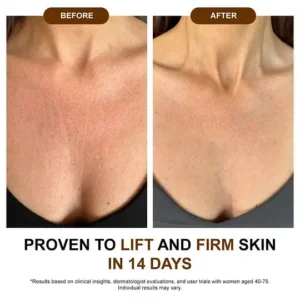 QIAWI® Silk Body Oil-Smooth Wrinkles & Firm Sagging Skin