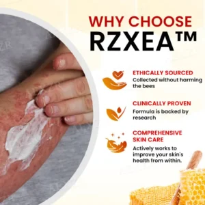 RZXEA™ Bee Venom Psoriasis Treatment Cream