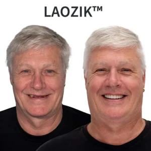 🔥 LAOZIKTM Custom-Fit Functional Dentures — Made in the USA, FDA Certified, Up to 70% OFF for a More Confident Smile!