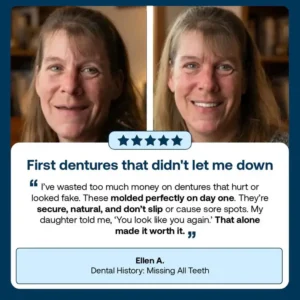 Yagoo™ Premium Full Denture Set