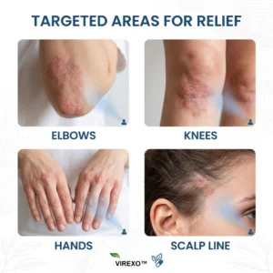 Virexo™ Magnesium Botanical Spray