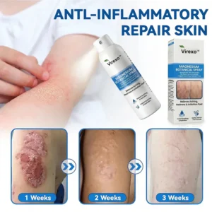 Virexo™ Magnesium Botanical Spray