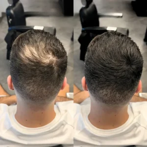 2026🎁LAST DAY 60％ OFF -YAGOO Haarverdichtungs-Puder