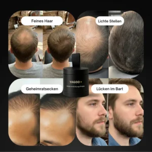 2026🎁LAST DAY 60％ OFF -YAGOO Haarverdichtungs-Puder