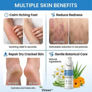 Virexo™ Magnesium Botanical Spray