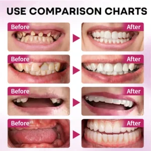 🎄💖Final 3 Hours:50%ОFF💥Yagoo™🦷 YAGOOFirmHold Denture Adhesive — Up to 10 Days of Slip-Free Hold🦷