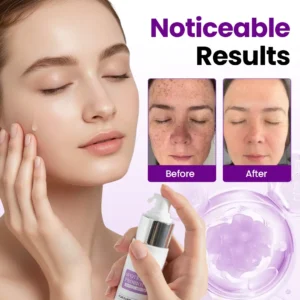 Tiworld® SpotErase Probiotic Shield Serum