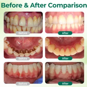 Virexo™ MENTHA-Waste Mouth Tabs