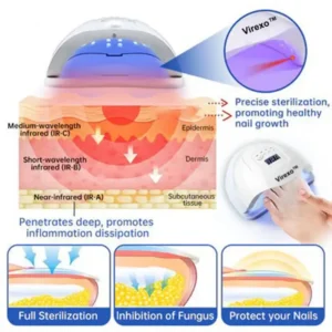 Virexo™ PureNail Fungus Laser Device
