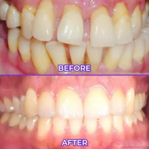 Virexo™ SensiGum Fluoride Toothpaste