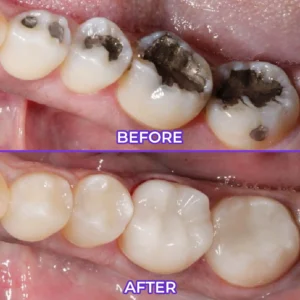 Virexo™ SensiGum Fluoride Toothpaste