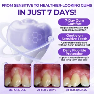 Virexo™ SensiGum Fluoride Toothpaste