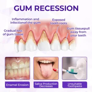 Virexo™ SensiGum Fluoride Toothpaste