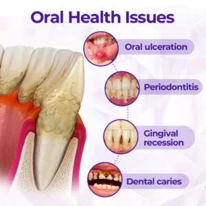 Virexo™ SensiGum Fluoride Toothpaste