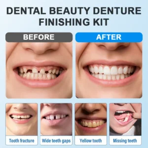 YAGOO™ Moldable Dentures – Affordable, Comfortable & Easy At-Home Fit