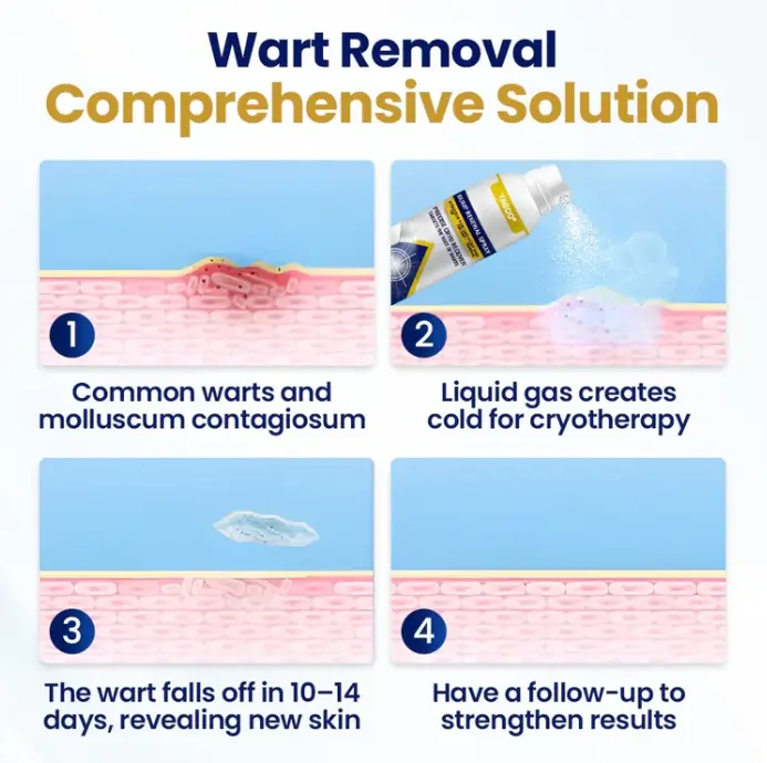 Yagoo® Chillique Bump Renewal Spray