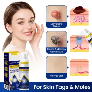 Yagoo® Chillique Bump Renewal Spray