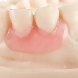 Yagoo® - Premium Denture
