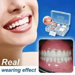 FOMONEST™ Full Denture with Strong Suctiond Custom-Fit Full Functional Dentures🦷