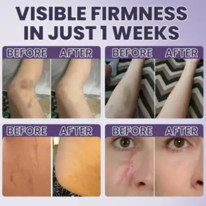 LIMETOW® Bruise Repair & Skin-Strengthening Cream