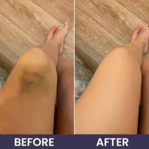 LIMETOW® Bruise Repair & Skin-Strengthening Cream