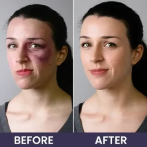 LIMETOW® Bruise Repair & Skin-Strengthening Cream