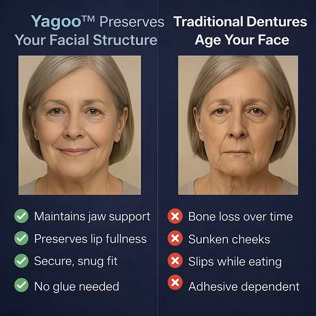 Yagoo™ Second-Generation Complete Denture Set