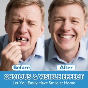 Heaceitr Premium Dentures
