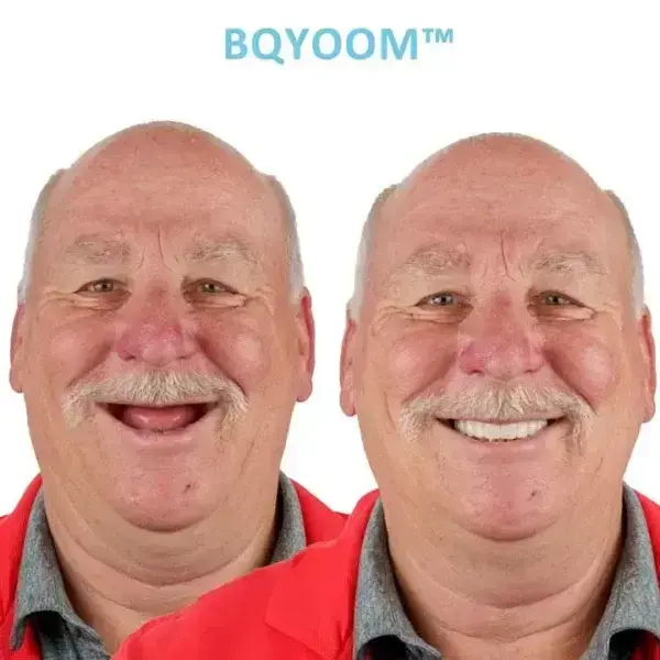 BQYOOM™ GelFit Dentures