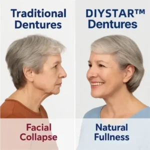 DIYSTAR™ Custom-Fit Functional Dentures