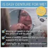 Easy Denture Upper Boil & Bite Denture (Small/Medium) | Self-Fitting