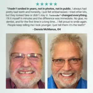 🌎Ends Today: 70% OFF! ⏰Trackmuller™ Medical Full Denture with Strong Suctiond