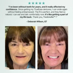 🌎Ends Today: 70% OFF! ⏰Trackmuller™ Medical Full Denture with Strong Suctiond