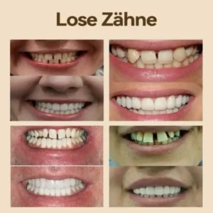 Hidone Premium Gebiss / Zahnprothese