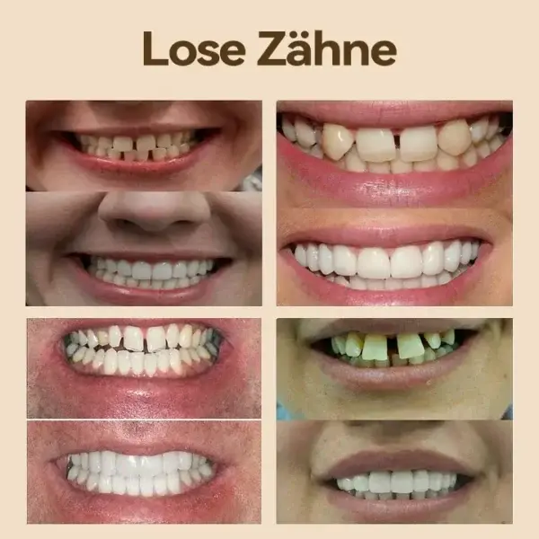 Hidone Premium Gebiss / Zahnprothese