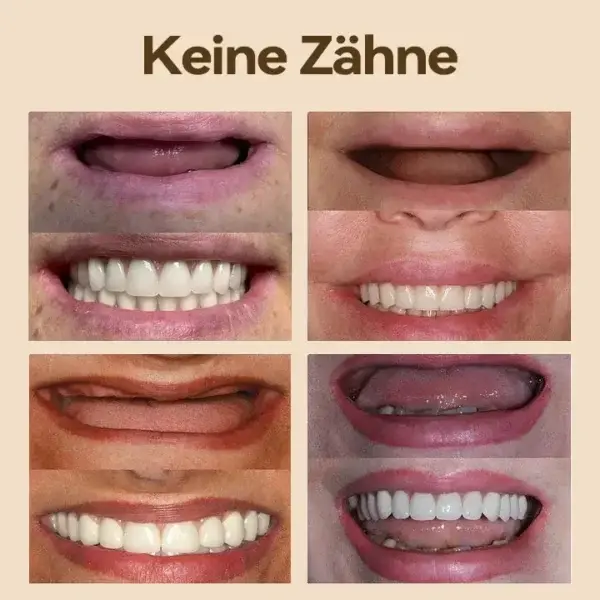 Hidone Premium Gebiss / Zahnprothese