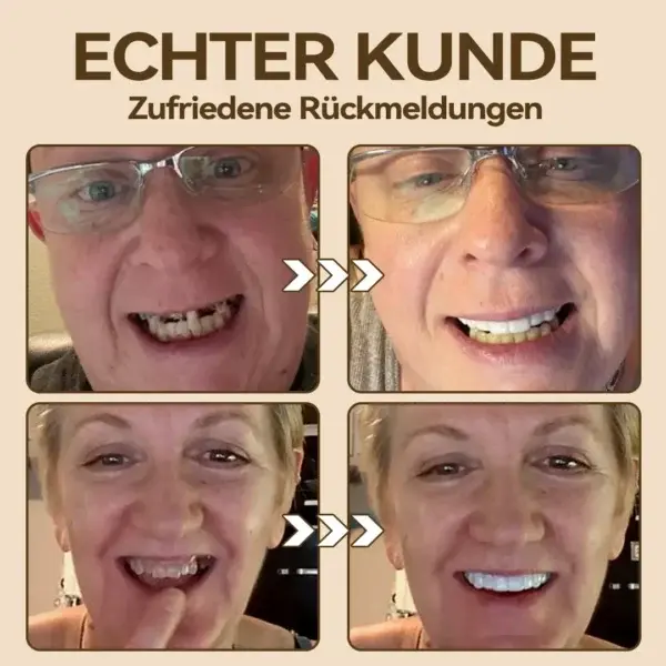 Hidone Premium Gebiss / Zahnprothese