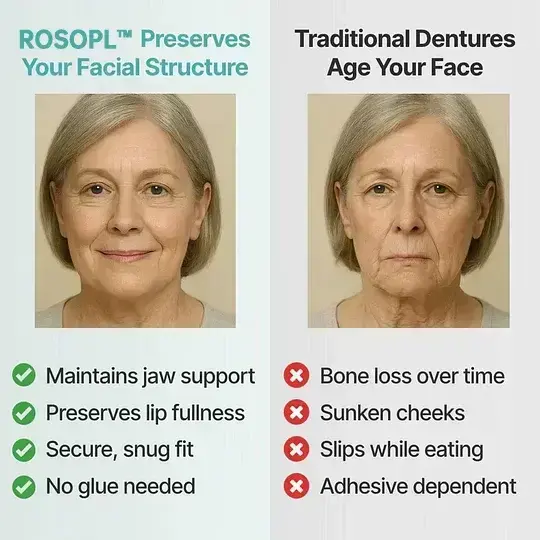 ROSOPL™ Custom-Fit Full Functional DenturesMake you more confident-Made in the USA