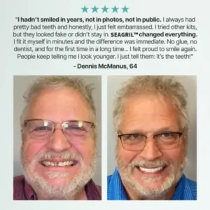 SEAGRIL™ Custom-Fit Full Functional Dentures