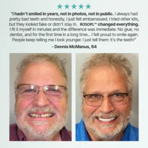 Shinneey™ Custom-Fit Functional Dentures