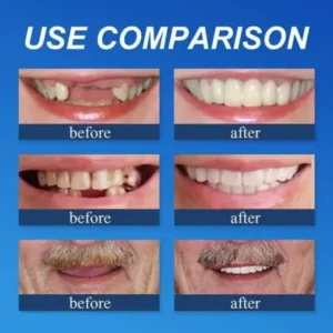 Trackmuller™ Medical Full Denture with Strong Suction