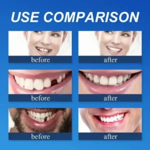 Trackmuller™ Medical Full Denture with Strong Suction