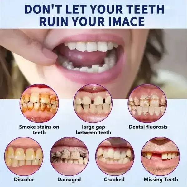 Vaxflite Full Denture Set (Top & Bottom) – Custom Fit Oral Prosthetic