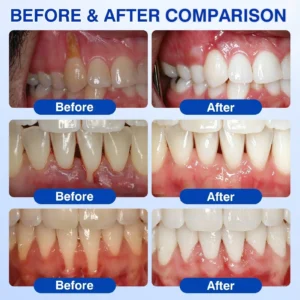 YAGOO® Periodontal Repair Gel