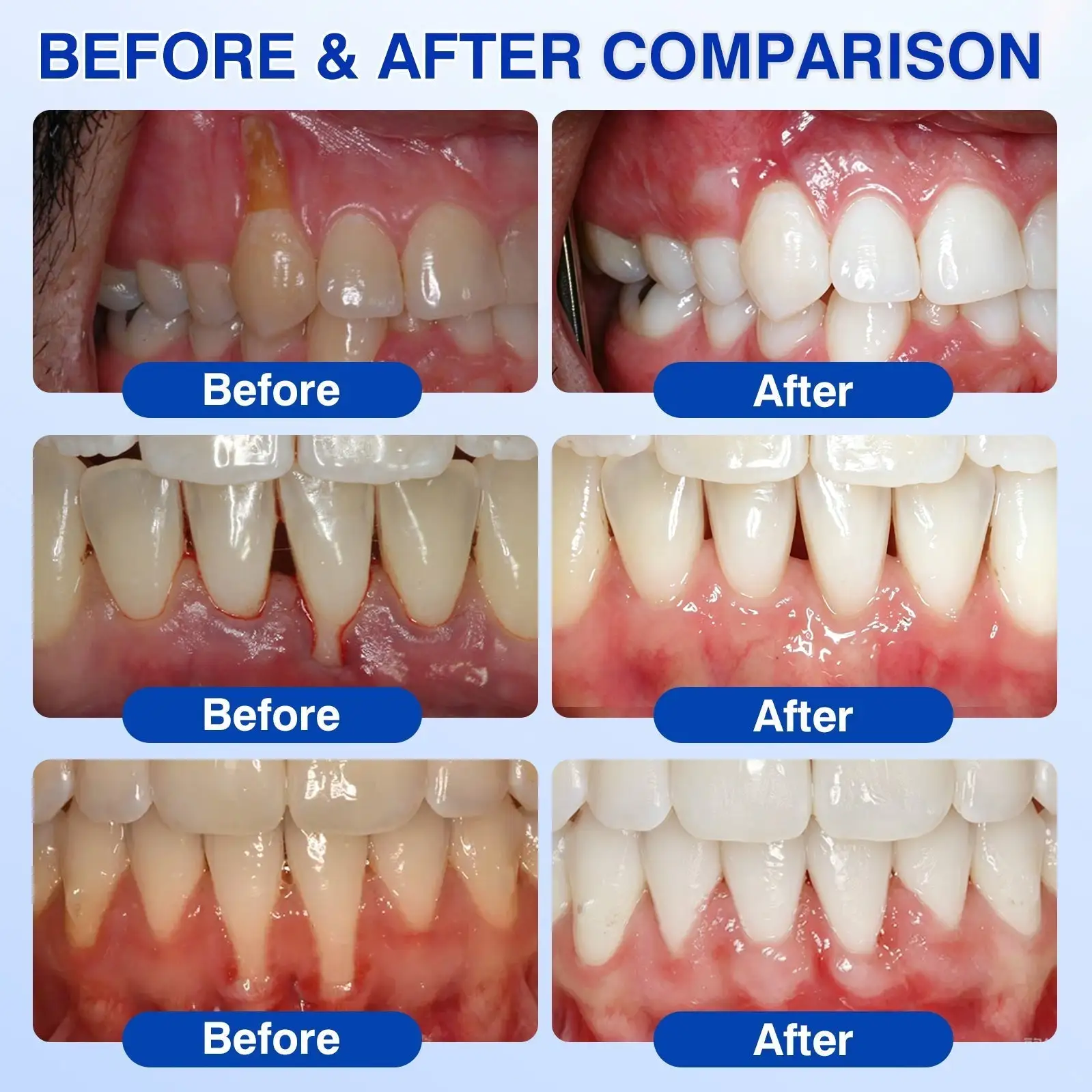 YAGOO® Periodontal Repair Gel